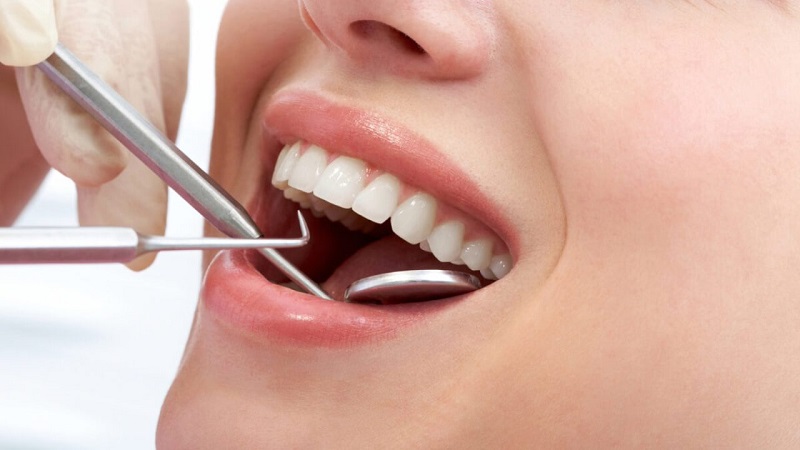 بهترین ایمپلنت اصفهان | بهترین دندانپزشک اصفهان | رفع مشکلات دندان‌های جلو با لمینت دندان | بهترین دندانپزشک اصفهان | دکتر ندا مکانیک