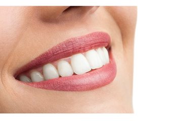 بهترین ایمپلنت اصفهان | بهترین دندانپزشک زیبایی اصفهان | روش های سفید کردن دندان زرد شده | بهترین دندانپزشک اصفهان | دکتر ندا مکانیک