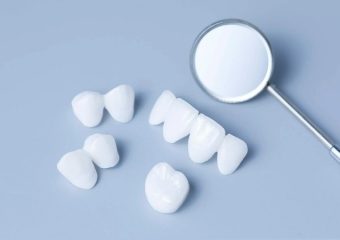 روکشهای تمام سرامیکی در بازسازی عملکردی دندانهای خلفی | بهترین ایمپلنت اصفهان | بهترین دندانپزشک اصفهان | دکتر ندا مکانیک