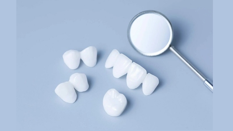 روکشهای تمام سرامیکی در بازسازی عملکردی دندانهای خلفی | بهترین ایمپلنت اصفهان | بهترین دندانپزشک اصفهان | دکتر ندا مکانیک