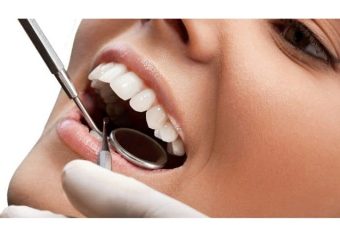 مدیریت عوارض لمینت دندان | بهترین ایمپلنت اصفهان | بهترین دندانپزشک اصفهان | دکتر ندا مکانیک