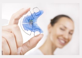 موارد مهم هنگام استفاده از نگهدارنده | بهترین ایمپلنت اصفهان | بهترین دندانپزشک اصفهان | دکتر ندا مکانیک