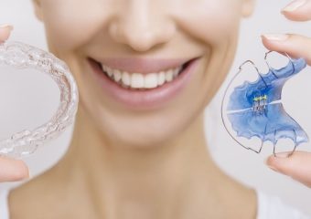 نحوه تمیز کردن نگهدارنده های دهانی | بهترین ایمپلنت اصفهان | بهترین دندانپزشک اصفهان | دکتر ندا مکانیک