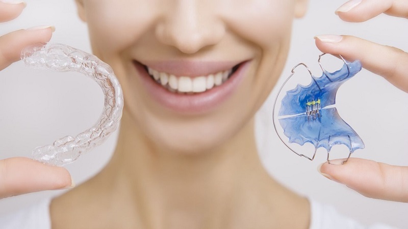 نحوه تمیز کردن نگهدارنده های دهانی | بهترین ایمپلنت اصفهان | بهترین دندانپزشک اصفهان | دکتر ندا مکانیک