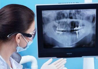 نقش رادیوگرافی دندان در تشخیص دقیق | بهترین دندانپزشک اصفهان | دکتر ندا مکانیک