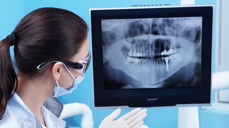 نقش رادیوگرافی دندان در تشخیص دقیق | بهترین دندانپزشک اصفهان | دکتر ندا مکانیک