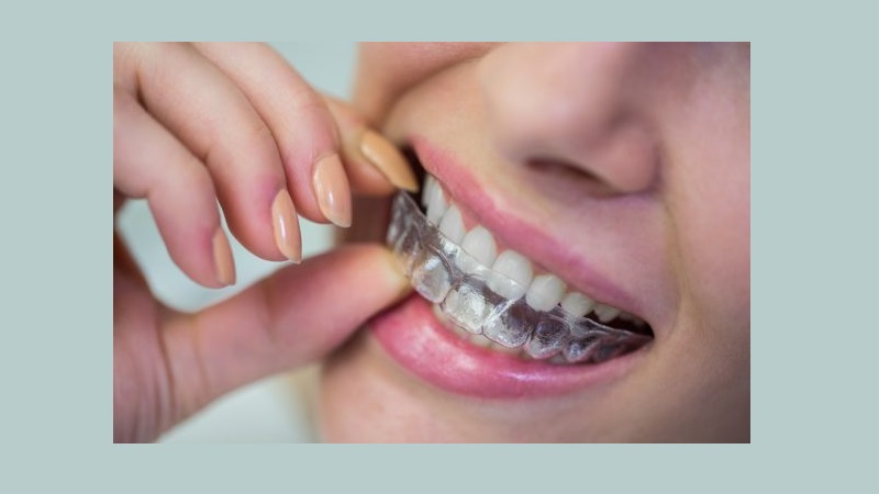 بهترین ایمپلنت اصفهان | بهترین دندانپزشک اصفهان | کاربرد انواع مختلف محافظ دهان | بهترین دندانپزشک اصفهان | دکتر ندا مکانیک