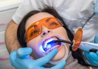 کاربرد کامپوزیت رزینی در ترمیمهای سریع | بهترین ایمپلنت اصفهان | بهترین دندانپزشک اصفهان | دکتر ندا مکانیک