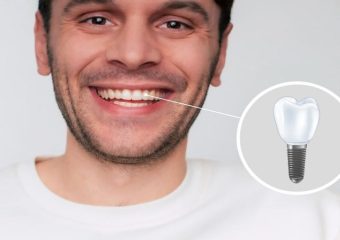 بهترین ایمپلنت اصفهان | بهترین دندانپزشک اصفهان | کاشت دندان طبیعی | بهترین دندانپزشک اصفهان | دکتر ندا مکانیک