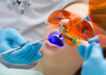 بهترین ایمپلنت اصفهان | بهترین دندانپزشک اصفهان | آشنایی با کامپوزیت لب شیشه‌ای دندان | بهترین دندانپزشک اصفهان | دکتر ندا مکانیک