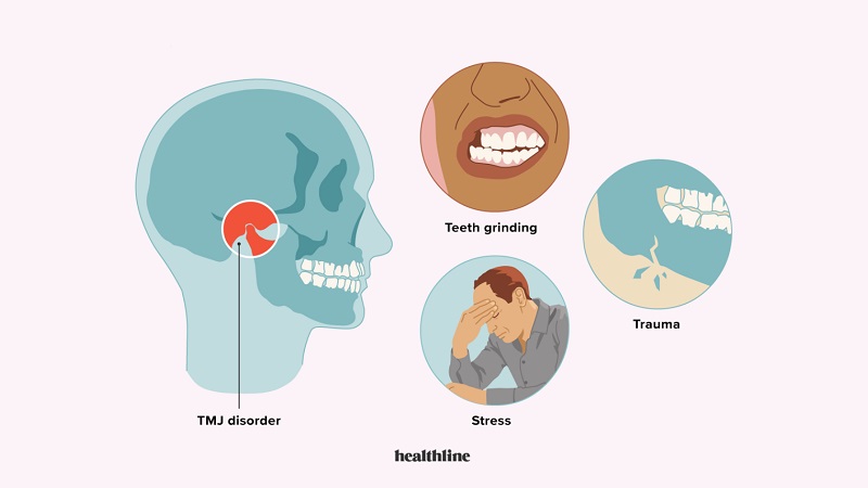 بهترین ایمپلنت اصفهان | بهترین دندانپزشک اصفهان | اختلال مفصل گیجگاهی فک پایین | بهترین دندانپزشک اصفهان | دکتر ندا مکانیک
