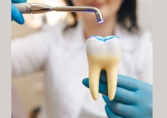 بهترین ایمپلنت اصفهان | بهترین دندانپزشک زیبایی اصفهان | بهترین دندانپزشک اصفهان | بهترین دندانپزشک کودکان اصفهان | ایجاد دندان قروچه پس از کامپوزیت