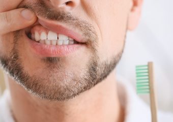 بهترین ایمپلنت اصفهان | بهترین دندانپزشک اصفهان |تاثیرات مصرف مشروبات الکلی بر سلامت دندان‌ها | بهترین دندانپزشک اصفهان | دکتر ندا مکانیک