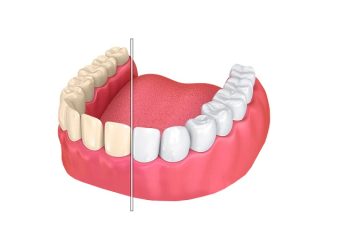 بهترین ایمپلنت اصفهان | بهترین دندانپزشک اصفهان | تغییر رنگ کامپوزیت دندان | بهترین دندانپزشک زیبایی اصفهان | دکتر ندا مکانیک