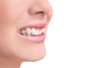 جابجا شدن دندان‌ها در بزرگسالان | بهترین ایمپلنت اصفهان | بهترین دندانپزشک اصفهان |دکتر ندا مکانیک