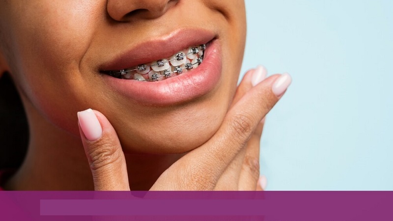 بهترین ایمپلنت اصفهان | عوامل مؤثر بر احتمال برگشت درمان ارتودنسی | بهترین دندانپزشک زیبایی اصفهان | دکتر ندا مکانیک