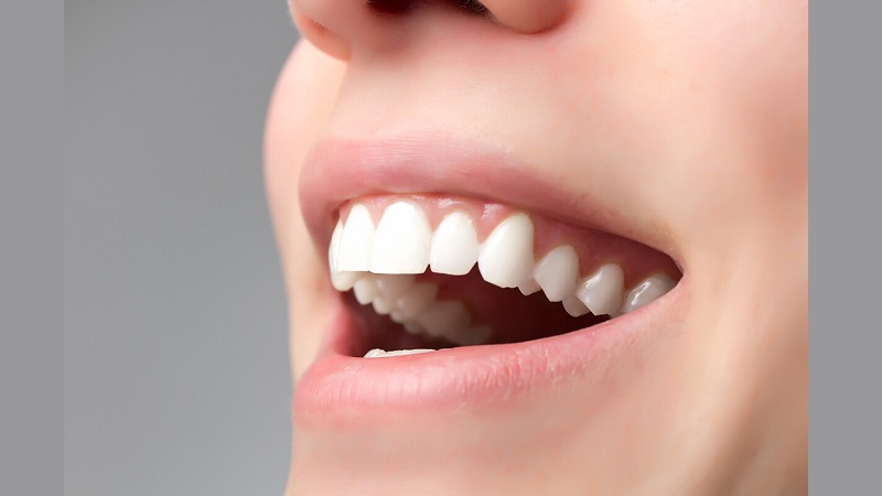 بازسازی زیبایی لثه هم‌زمان با ایمپلنت دندان | بهترین دندانپزشک زیبایی اصفهان | دکتر مکانیک | بهترین دندانپزشک اصفهان | بهترین دندانپزشک کودکان اصفهان | دکتر ندا مکانیک