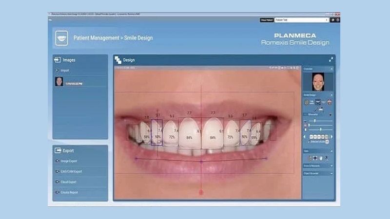 نقش تکنولوژی واقعیت افزوده در پیش‌نمایش طرح لبخند | بهترین ایمپلنت اصفهان | بهترین دندانپزشک زیبایی اصفهان | دکتر مکانیک | بهترین دندانپزشک اصفهان | بهترین دندانپزشک کودکان اصفهان | دکتر ندا مکانیک
