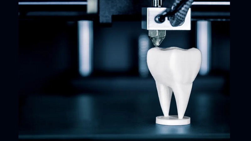 پرینت سه‌بعدی در ساخت روکش و پروتز دندانی | بهترین ایمپلنت اصفهان | بهترین دندانپزشک اصفهان | دکتر ندا مکانیک