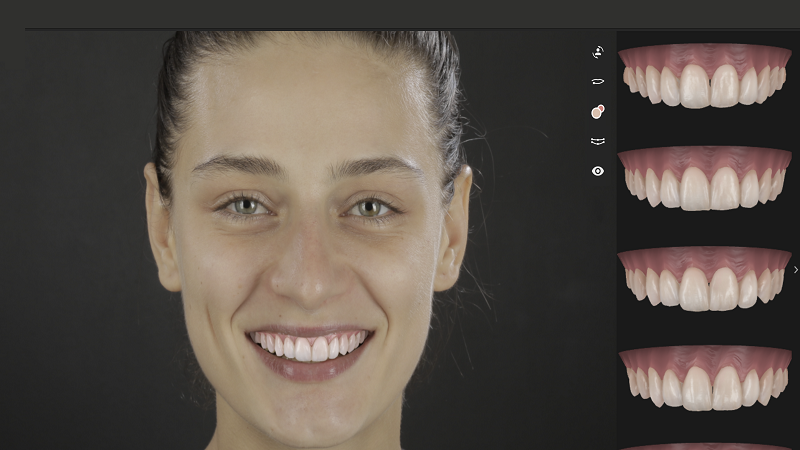 استفاده از اسکن سه‌بعدی و طراحی لبخند | بهترین دندانپزشک زیبایی اصفهان | دکتر مکانیک | بهترین دندانپزشک اصفهان | بهترین دندانپزشک کودکان اصفهان | دکتر ندا مکانیک