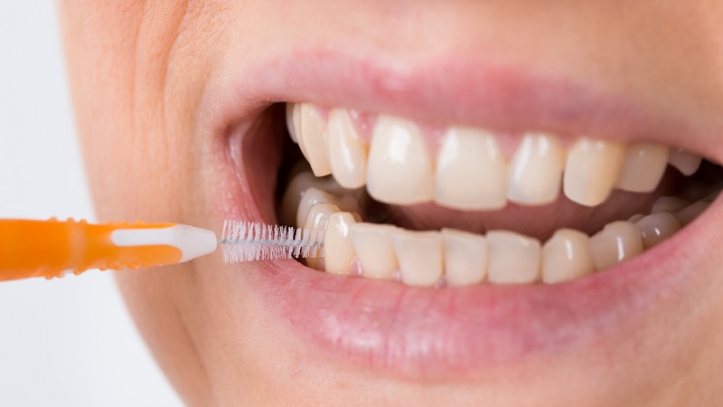 اشتباهات رایج در نگهداری ایمپلنت | بهترین ایمپلنت اصفهان | دکتر ندا مکانیک