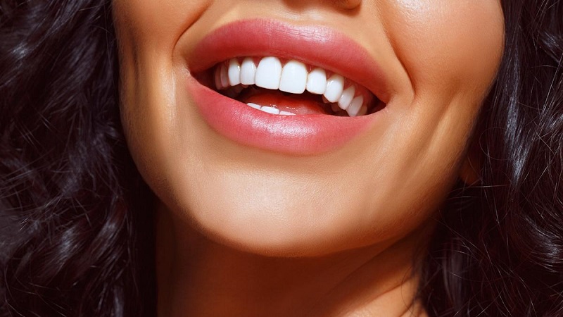 تأثیر کاشت ایمپلنت دندان بر زیبایی لبخند | بهترین دندانپزشک زیبایی اصفهان | دکتر ندا مکانیک