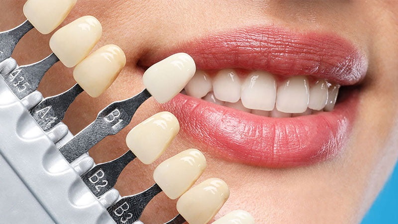 دندان هایتان را لمینت نکنید | بهترین دندانپزشک کودکان اصفهان | دکتر ندا مکانیک