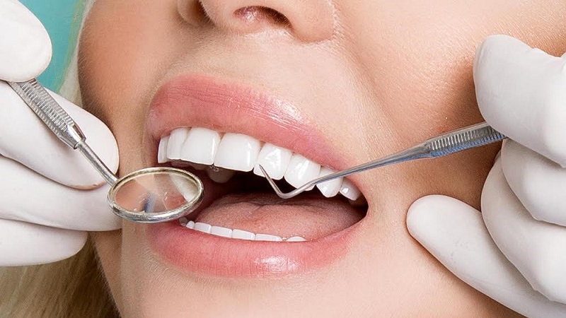 راز طول عمر لمینت‌های دندانی | بهترین دندانپزشک زیبایی اصفهان | دکتر مکانیک | بهترین دندانپزشک اصفهان | بهترین دندانپزشک کودکان اصفهان | دکتر ندا مکانیک