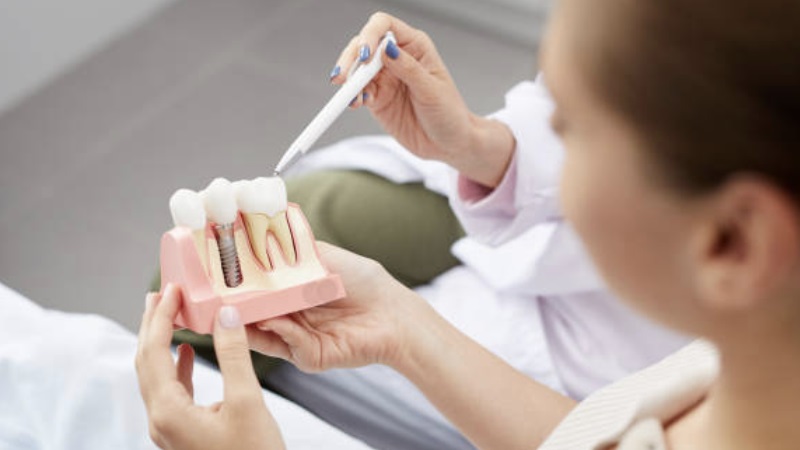 راهکارهای جلوگیری از کاشت ناموفق ایمپلنت دندان | بهترین ایمپلنت اصفهان | دکتر ندا مکانیک | بهترین دندانپزشک زیبایی اصفهان | دکتر مکانیک | بهترین دندانپزشک اصفهان | بهترین دندانپزشک کودکان اصفهان |