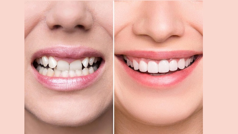 بهترین ایمپلنت اصفهان | بهترین دندانپزشک زیبایی اصفهان | دکتر مکانیک | بهترین دندانپزشک اصفهان | بهترین دندانپزشک کودکان اصفهان | طرح لبخند چیست؟