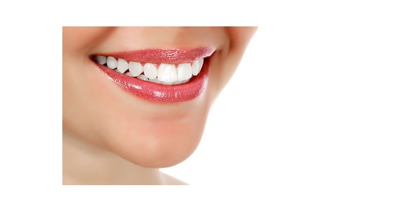 معرفی روش های مختلف بیلیچینگ | بهترین ایمپلنت اصفهان | بهترین دندانپزشک زیبایی اصفهان | دکتر مکانیک | بهترین دندانپزشک اصفهان | بهترین دندانپزشک کودکان اصفهان | دکتر ندا مکانیک