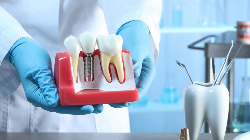 معیارهای انتخاب دندانپزشک معتبر برای کاشت ایمپلنت دندان | بهترین دندانپزشک زیبایی اصفهان | دکتر مکانیک | بهترین دندانپزشک اصفهان | بهترین دندانپزشک کودکان اصفهان | دکتر ندا مکانیک