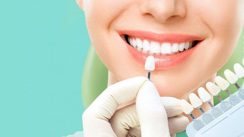 بهترین ایمپلنت اصفهان | بهترین دندانپزشک زیبایی اصفهان | بهترین دندانپزشک اصفهان | بهترین دندانپزشک کودکان اصفهان | مقایسه کامل ونیر کامپوزیت و لمینت | دکتر ندا مکانیک