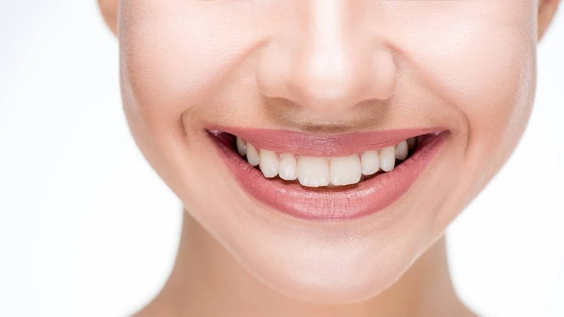 بهترین ایمپلنت اصفهان | بهترین دندانپزشک زیبایی اصفهان | دکتر مکانیک | بهترین دندانپزشک اصفهان | بهترین دندانپزشک کودکان اصفهان | نقش ارتفاع لثه در زیبایی دندان‌ها | بهترین دندانپزشک زیبایی اصفهان | دکتر ندا مکانیک