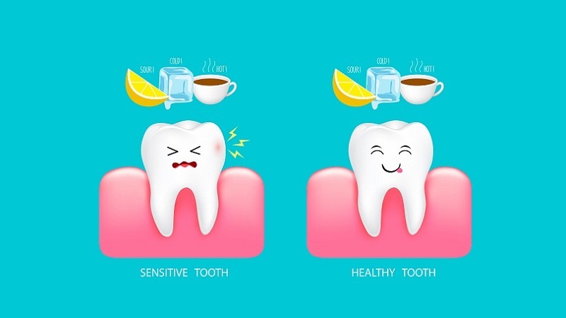 مدیریت بالینی پوسیدگی زودرس دندان | بهترین دندانپزشک زیبایی اصفهان | دکتر ندا مکانیک