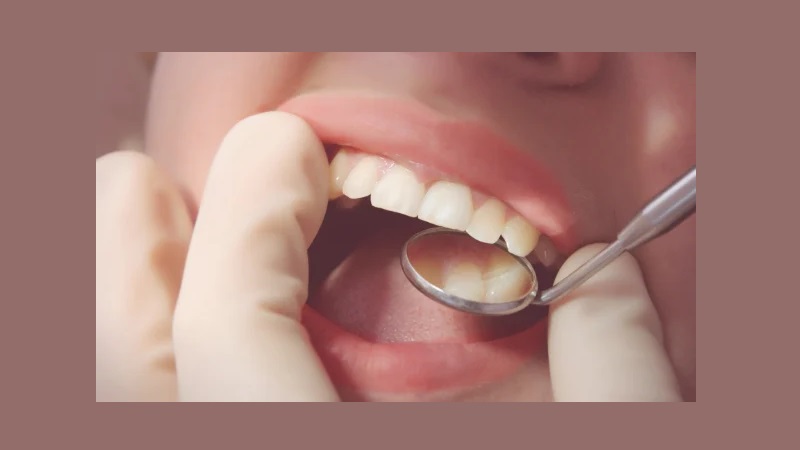 بهترین ایمپلنت اصفهان | بهترین دندانپزشک زیبایی اصفهان | دکتر ندا مکانیک | کامپوزیت اقتصادی یا گران؟ | بهترین دندانپزشک زیبایی اصفهان | دکتر ندا مکانیک