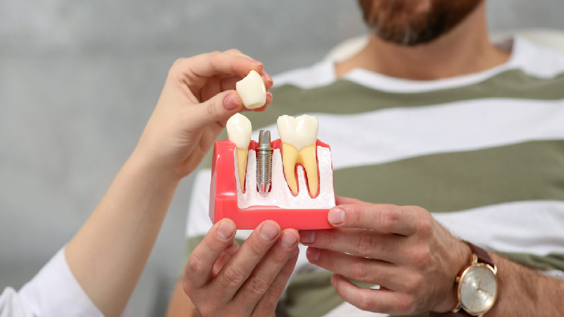 بهترین ایمپلنت اصفهان | بهترین دندانپزشک زیبایی اصفهان | دکتر ندا مکانیک | سوالات رایج از متخصص ایمپلنت دندان