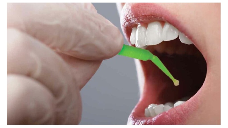 بهترین ایمپلنت اصفهان | بهترین دندانپزشک زیبایی اصفهان | دکتر مکانیک | بهترین دندانپزشک اصفهان | بهترین دندانپزشک کودکان اصفهان | راز توقف پوسیدگی بدون پر کردن