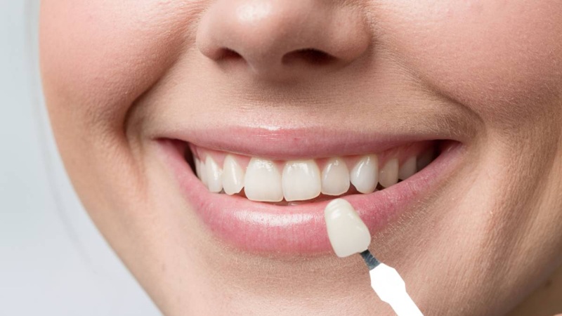 بهترین ایمپلنت اصفهان | بهترین دندانپزشک زیبایی اصفهان | دکتر مکانیک | بهترین دندانپزشک اصفهان | بهترین دندانپزشک کودکان اصفهان | روکش‌های سرامیکی یکپارچه در دندانپزشکی زیبایی