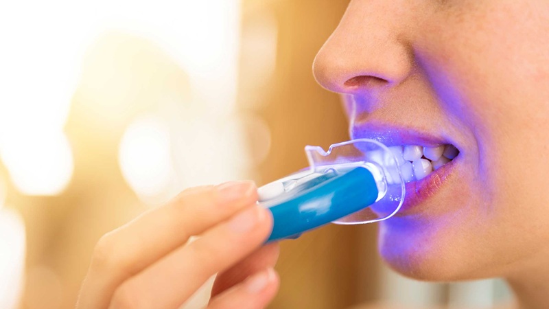 بهترین ایمپلنت اصفهان | بهترین دندانپزشک زیبایی اصفهان | دکتر مکانیک | بهترین دندانپزشک اصفهان | بهترین دندانپزشک کودکان اصفهان | سفید کردن دندان‌ها در خانه