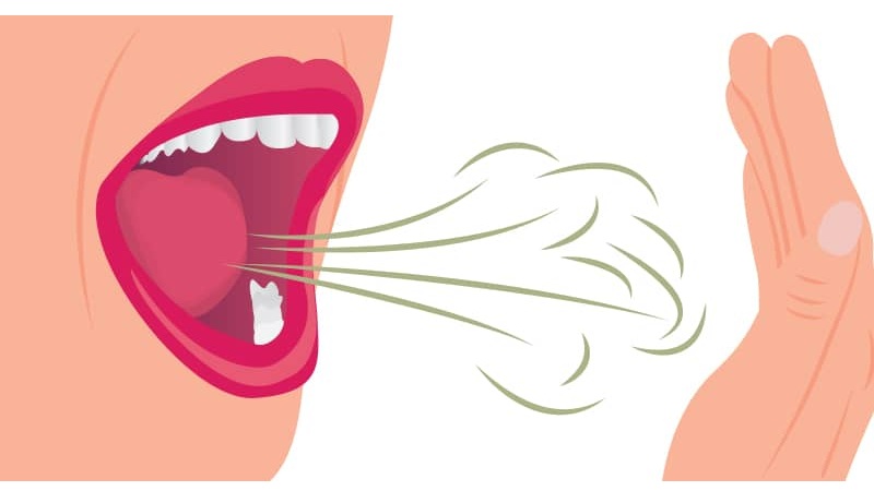 بهترین ایمپلنت اصفهان | بهترین دندانپزشک زیبایی اصفهان | دکتر مکانیک | بهترین دندانپزشک اصفهان | بهترین دندانپزشک کودکان اصفهان | علل شایع و راهکارهای عملی پیشگیری از بوی بد دهان