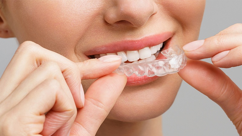 بهترین ایمپلنت اصفهان | بهترین دندانپزشک زیبایی اصفهان | دکتر مکانیک | بهترین دندانپزشک اصفهان | بهترین دندانپزشک کودکان اصفهان | مزایا و محدودیت‌های ارتودنسی نامرئی با الاینرهای شفاف