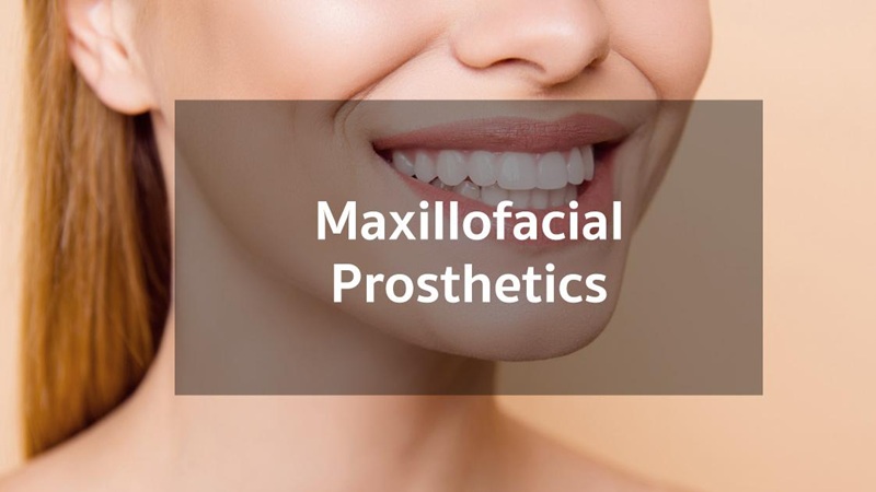 بهترین ایمپلنت اصفهان | بهترین دندانپزشک زیبایی اصفهان | دکتر مکانیک | بهترین دندانپزشک اصفهان | بهترین دندانپزشک کودکان اصفهان | پروتزهای فک و صورت برای بازگرداندن اعتماد به نفس پس از جراحی