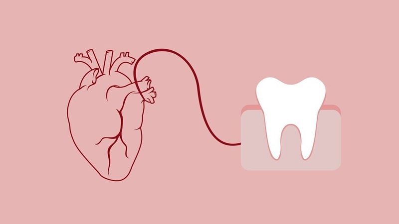 بهترین ایمپلنت اصفهان | بهترین دندانپزشک زیبایی اصفهان | دکتر مکانیک | بهترین دندانپزشک اصفهان | بهترین دندانپزشک کودکان اصفهان | چگونه سلامت دهان بر قلب شما تاثیر می‌گذارد؟
