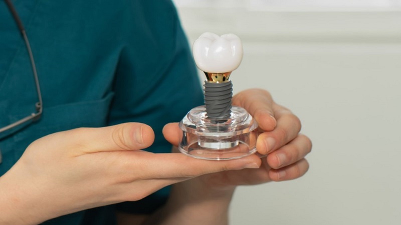 بهترین ایمپلنت اصفهان | بهترین دندانپزشک زیبایی اصفهان | بهترین دندانپزشک اصفهان | بهترین دندانپزشک کودکان اصفهان | دکتر مکانیک | 9 عامل تاثیرگذار در ماندگاری ایمپلنت دندان