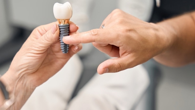 بهترین ایمپلنت اصفهان | بهترین دندانپزشک زیبایی اصفهان | دکتر مکانیک | بهترین دندانپزشک اصفهان | بهترین دندانپزشک کودکان اصفهان | خطرات مرتبط با ایمپلنت در افراد دیابتی