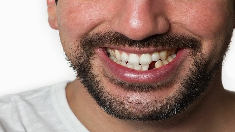 بهترین ایمپلنت اصفهان | بهترین دندانپزشک زیبایی اصفهان | بهترین دندانپزشک اصفهان | بهترین دندانپزشک کودکان اصفهان | عوارض خالی گذاشتن جای دندان کشیده شده