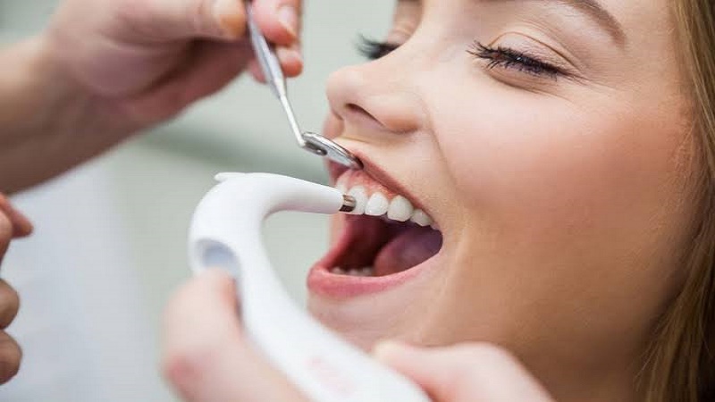 آیا جرم‌گیری قبل از لمینت و کامپوزیت لازم است؟