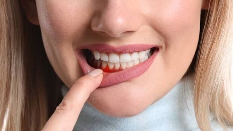 سلامت دهان با بیماری‌های زمینه‌ای